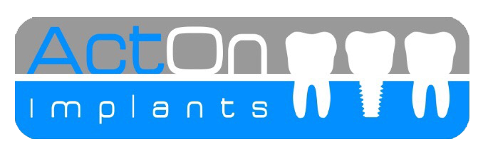 ActOn Implants